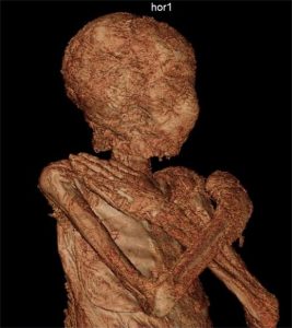 CT scan of the mummy (by Warsaw Mummy Project)